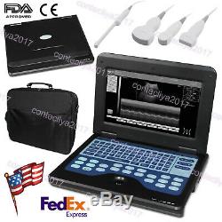 10.1 FDA Digital ultrasound scanner Portable laptop machine 2 probes USA Fedex