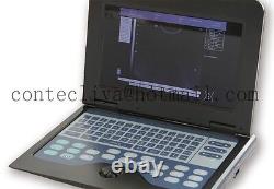 10.1'' Portable Ultrasound Scanner Digital Laptop Machine Convex+Linear 2 Probes