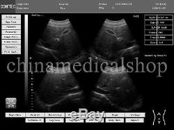 10.1 inch Portable Ultrasound Scanner Laptop Machine human use 2 probes FDA USA