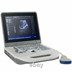 12 Portable Laptop 3D Digital Ultrasound Scanner Machine + 3.5MHZ Convex Probe