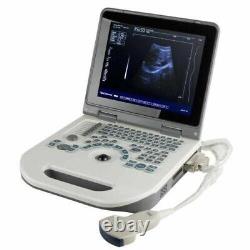 12 Portable Laptop 3D Digital Ultrasound Scanner Machine + 3.5MHZ Convex Probe