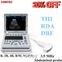 15 Portable Ultrasound Scanner Diagnostic Laptop Machine Convex Probe PW USA