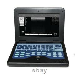 3.5 Convex probe US FedEx Portable laptop machine Digital Ultrasound scanner FDA