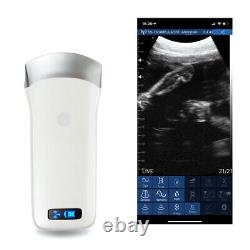 3.5Mhz Digital Medical Handheld Wireless Ultrasound Scanner Linear Probe Carejoy