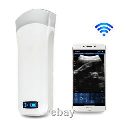 3.5Mhz Digital Medical Handheld Wireless Ultrasound Scanner Linear Probe Carejoy