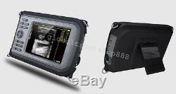 3D Laptop Digital Ultrasound Scanner Diagnostic Scaner+Linear+Free Box+Battery