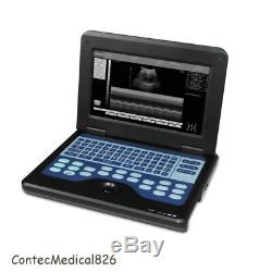 4 Probes Ultrasound Scanner Laptop Machine CONVEX+Linear+Transvaginal+Cardiac