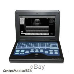 4 Probes Ultrasound Scanner Laptop Machine CONVEX+Linear+Transvaginal+Cardiac