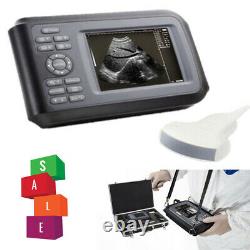 5.5'' Carejoy Digital Handheld Ultrasound Scanner Machine+3.5MHZ Convex Probe CE