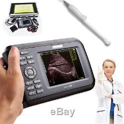 5.5''Color LCD Digital Handheld Ultrasound Scanner HandScan +Transvaginal Probe