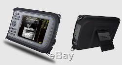 5.5''Color LCD Digital Handheld Ultrasound Scanner HandScan +Transvaginal Probe