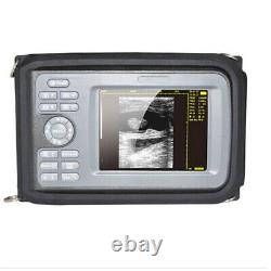 5.5'' Handheld Ultrasound Machine Scanner Digital+Convex Probe Human New