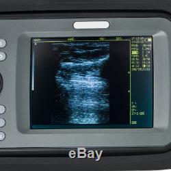 5.5 Handheld Ultrasound Machine Scanner Digital Micro-convex Probe Human w Gift