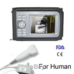 5.5 TFT Human Portable Handheld Digital Ultrasound Scanner 7.5Mhz Linear probe