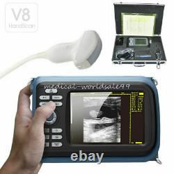 5.5 inch Handheld Ultrasound Machine Scanner Digital+Convex Probe For Human FDA