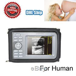 5.5 inch Handheld Ultrasound Machine Scanner Digital Micro-convex Human CE FDA