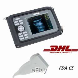 5.5Inch Digital Portable Handheld Ultrasound Scanner+7.5MHz Linear Probe Vet Use