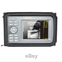 5.5inch Handheld Digital Ultrasound Scanner Machine+Convex Probe+Gift Oximeter