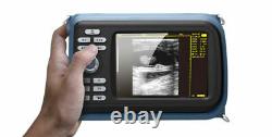 5.5inch Handheld Ultrasound Scanner Digital Machine &Linear& Box &Battery Kit