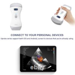 Animal VET Color Doppler Handheld Digital Ultrasound Scanner Convex+Linear Probe