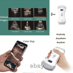Animal VET Color Doppler Handheld Digital Ultrasound Scanner Convex+Linear Probe
