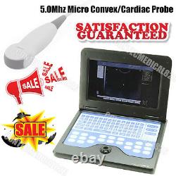 CE 10.1 Inch LCD Laptop Ultrasound Scanner Digital Diagnostic Machine+Cardiac