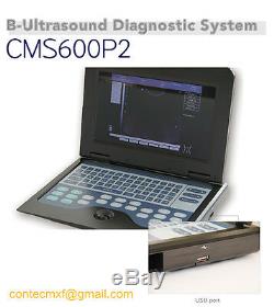 CE 10.1 Inch LCD Laptop Ultrasound Scanner Digital Diagnostic Machine+Cardiac