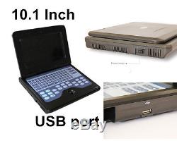 CE CMS600P2 Portable Laptop machine Digital Ultrasound scanner 2 Probes, Notebook