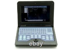 CE Contec CMS600P2 Laptop Ultrasound Scanner Machine With 7.5Mhz Linear Probe