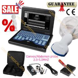 CE&FDA, Portable laptop machine Digital Ultrasound scanner, 3.5M Convex probe, New