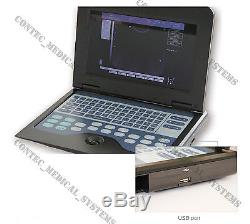 CE&FDA, Portable laptop machine Digital Ultrasound scanner, 3.5M Convex probe, New