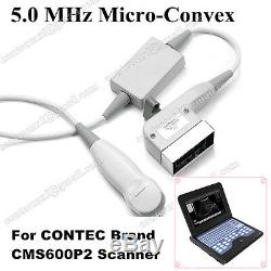CE Full Digital Laptop Ultrasound Scanner Diagnostic Sytems + Micro Convex Probe