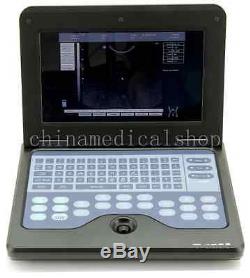 CE Full Digital Ultrasound scanner diagnostic system machine 3.5M convex probe