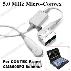 CE New Digital Laptop B Ultrasound Scanner Machine With 5.0Mhz Micro Convex