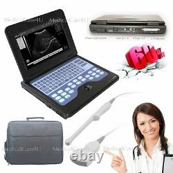 CE New Digital Ultrasound Scanner Laptop Machine+Transvaginal+Convex 2 Probes