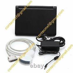 CE New Digital Ultrasound Scanner Laptop Machine+Transvaginal+Convex 2 Probes