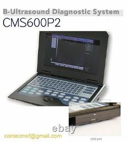 CE New Digital Ultrasound Scanner Laptop Machine+Transvaginal+Convex 2 Probes