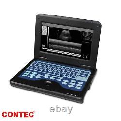 CE Portable Laptop Machine Digital Ultrasound Scanner+ Linear+ Convex 2 Probes