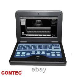 CE Portable Laptop Machine Digital Ultrasound Scanner+ Linear+ Convex 2 Probes