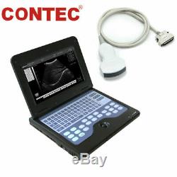 CE Portable Ultrasound Scanner Laptop Machine 3.5 Convex probe, Optional linear