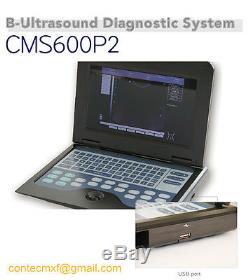 CE Veterinary Digital Laptop Ultrasound Scanner 3.5M Convex Probe-Cat, dog, sheep