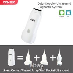 CMS1600A 3 in 1 color Doppler ultrasound Scanner diagnostic system convex Linear