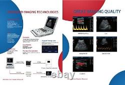 CMS1700A Color Doppler Ultrasonic Diagnostic CF Ultrasound Scanner+Linear Probe