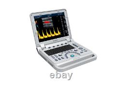 CMS1700A Color Doppler Ultrasonic Diagnostic CF Ultrasound Scanner+Linear Probe