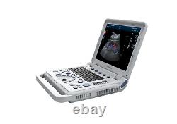 CMS1700A Color Doppler Ultrasonic Diagnostic CF Ultrasound Scanner+Linear Probe