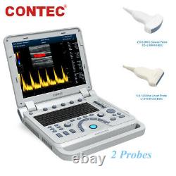 CMS1700A Portable Color Ultrasound Scanner Color Doppler Linear/Convex 2 Probes