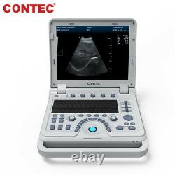 CMS1700A Portable Color Ultrasound Scanner Color Doppler Linear/Convex 2 Probes