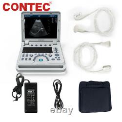 CMS1700A Portable Color Ultrasound Scanner Color Doppler Linear/Convex 2 Probes