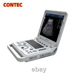 CMS1700A-VET Color Doppler Portable Ultrasound Scanner Laptop Linear Probe New