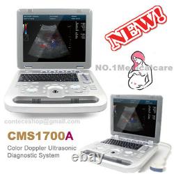 CMS1700A color Doppler ultrasonic diagnostic Scanner with USB, 3.5 Convex Probe